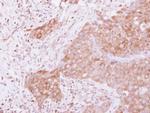 GSPT1 Antibody in Immunohistochemistry (Paraffin) (IHC (P))