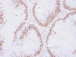 ZMYM2 Antibody in Immunohistochemistry (Paraffin) (IHC (P))