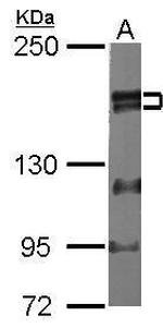 ZMYM2 Antibody in Western Blot (WB)