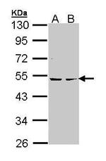 PRKAR2B Antibody in Western Blot (WB)