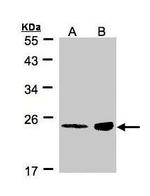 RRAS Antibody in Western Blot (WB)