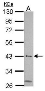 MSL3 Antibody in Western Blot (WB)