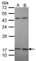 KCNMB1 Antibody in Western Blot (WB)