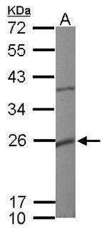 KCNMB1 Antibody in Western Blot (WB)