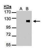 ZNF281 Antibody in Western Blot (WB)