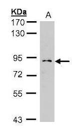 GCS1 Antibody in Western Blot (WB)