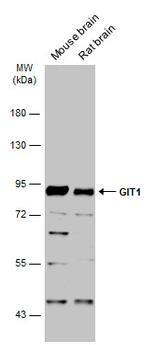 GIT1 Antibody in Western Blot (WB)