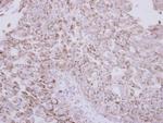 Protein C Antibody in Immunohistochemistry (Paraffin) (IHC (P))