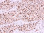 RAD21 Antibody in Immunohistochemistry (Paraffin) (IHC (P))