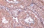 RAD21 Antibody in Immunohistochemistry (Paraffin) (IHC (P))