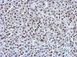 RAD21 Antibody in Immunohistochemistry (Paraffin) (IHC (P))