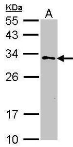 GSTZ1 Antibody in Western Blot (WB)