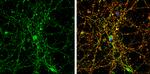 GLRA1 Antibody in Immunocytochemistry (ICC/IF)