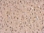 HSPA1B Antibody in Immunohistochemistry (Paraffin) (IHC (P))