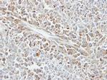 HSPA1B Antibody in Immunohistochemistry (Paraffin) (IHC (P))