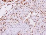 Carboxypeptidase E Antibody in Immunohistochemistry (Paraffin) (IHC (P))