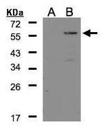 Carboxypeptidase E Antibody in Western Blot (WB)