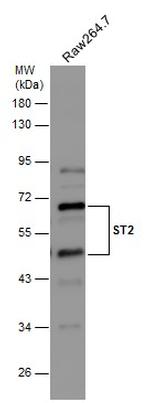 ST2 Antibody in Western Blot (WB)