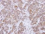 CD2AP Antibody in Immunohistochemistry (Paraffin) (IHC (P))