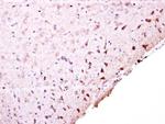 PFKFB4 Antibody in Immunohistochemistry (Paraffin) (IHC (P))