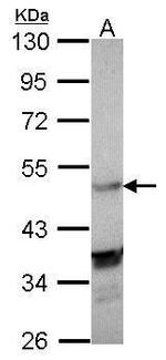 LXR alpha Antibody in Western Blot (WB)