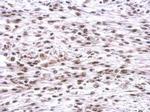 HP1 beta Antibody in Immunohistochemistry (Paraffin) (IHC (P))