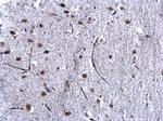 HP1 beta Antibody in Immunohistochemistry (Paraffin) (IHC (P))