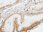 Coronin 1A Antibody in Immunohistochemistry (Paraffin) (IHC (P))