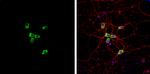 Coronin 1A Antibody in Immunocytochemistry (ICC/IF)