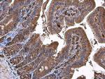 Coronin 1A Antibody in Immunohistochemistry (Paraffin) (IHC (P))