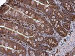 Coronin 1A Antibody in Immunohistochemistry (Paraffin) (IHC (P))