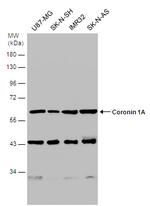 Coronin 1A Antibody in Western Blot (WB)