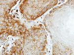 eIF2 beta Antibody in Immunohistochemistry (Paraffin) (IHC (P))