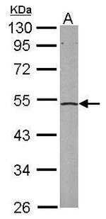 eIF2 beta Antibody in Western Blot (WB)