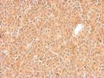 GGPS1 Antibody in Immunohistochemistry (Paraffin) (IHC (P))