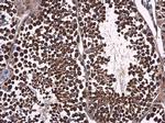 p23 Antibody in Immunohistochemistry (Paraffin) (IHC (P))