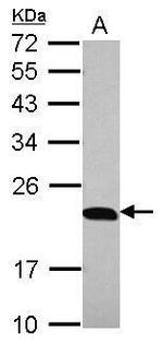 p23 Antibody in Western Blot (WB)