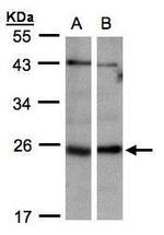 ITPA Antibody in Western Blot (WB)