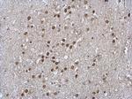 LIMD1 Antibody in Immunohistochemistry (Paraffin) (IHC (P))