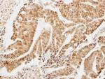 LIMD1 Antibody in Immunohistochemistry (Paraffin) (IHC (P))