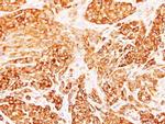 DIABLO Antibody in Immunohistochemistry (Paraffin) (IHC (P))