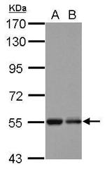 KBTBD4 Antibody in Western Blot (WB)