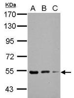 KBTBD4 Antibody in Western Blot (WB)