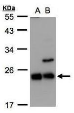 CBF beta Antibody in Western Blot (WB)