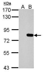 SLU7 Antibody in Western Blot (WB)