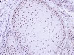 PRP19 Antibody in Immunohistochemistry (Paraffin) (IHC (P))