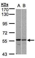 PRP19 Antibody in Western Blot (WB)