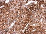 PHF16 Antibody in Immunohistochemistry (Paraffin) (IHC (P))