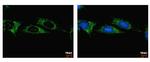 ALDH1B1 Antibody in Immunocytochemistry (ICC/IF)