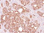 ALDH1B1 Antibody in Immunohistochemistry (Paraffin) (IHC (P))